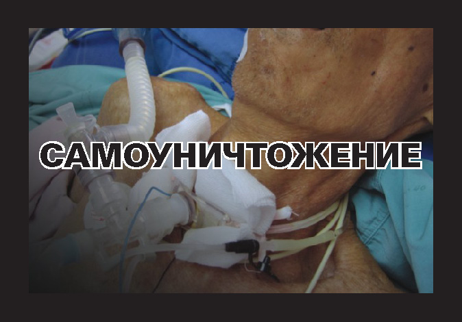 Russia 2013 Health Effect death - slow and painful death, lived experience